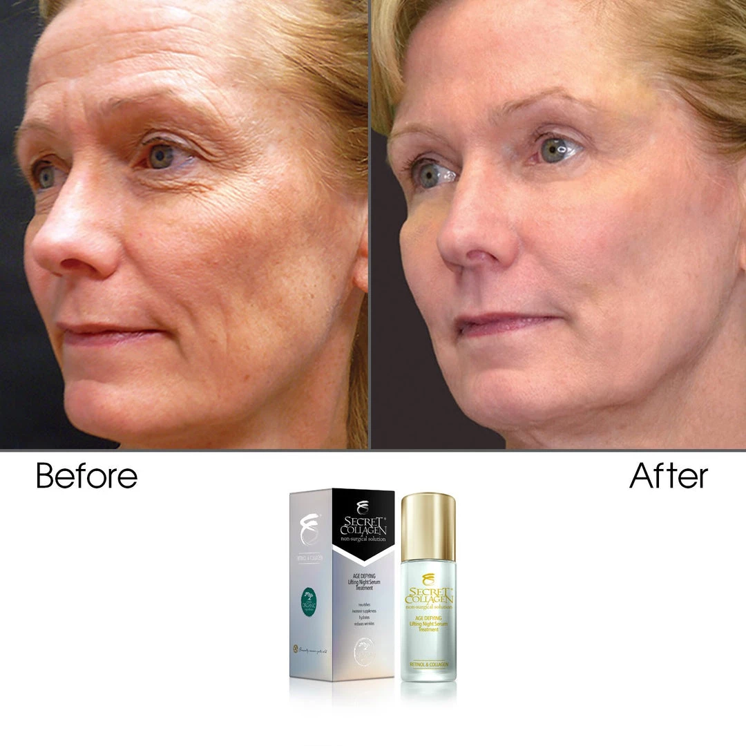 Flash Sale 🔔 Secret Collagen Age Defying Lifting Night Serum Treatment 🎁 - Image 2