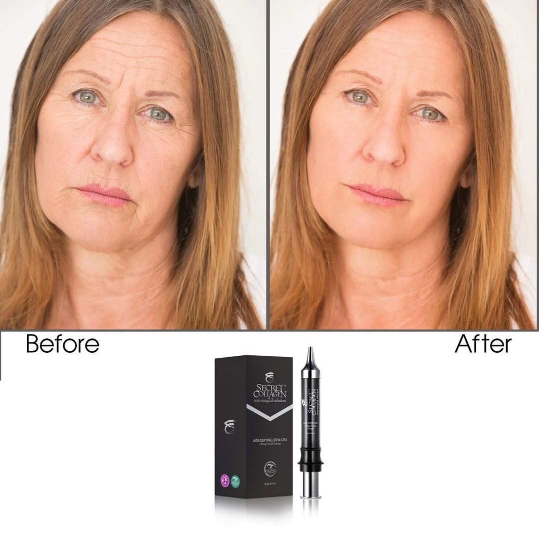 Outlet 🥰 Secret Collagen Age Defying Apple & Grape Stem Cell Lifting Facial ⭐ - Image 2