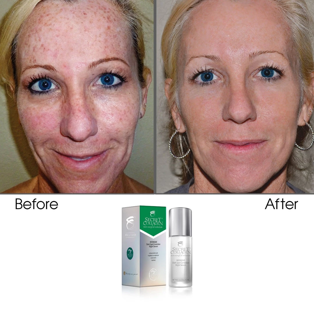 Promo ❤️ Secret Collagen Intensive Dark Spot Correction Night Serum ✔️ - Image 2
